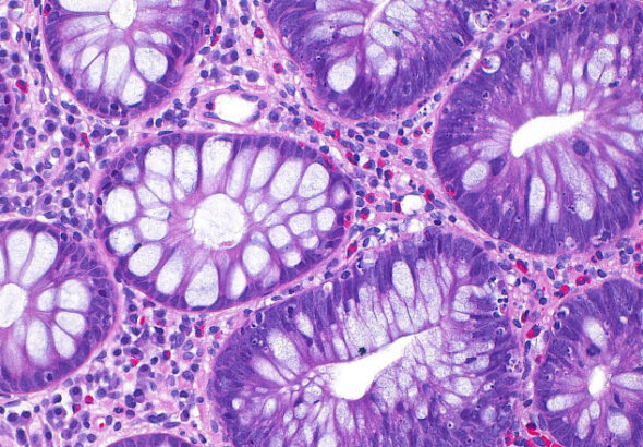 Mjk1Njk5Mzk0YWU5NDlhZmY1MDQ3NDlkYmZlNGRkZA==.thumb