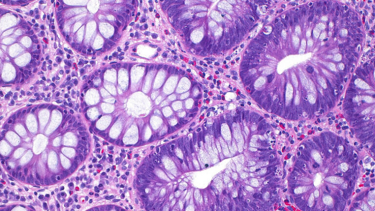 Mjk1Njk5Mzk0YWU5NDlhZmY1MDQ3NDlkYmZlNGRkZA==.thumb